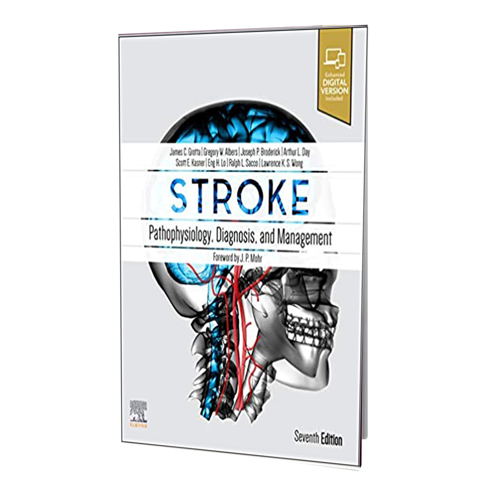 کتاب Stroke Pathophysiology Diagnosis and Management