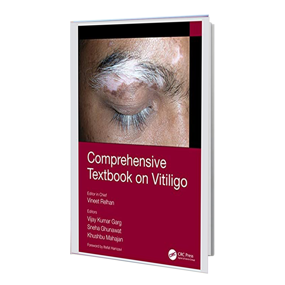 کتاب Comprehensive Textbook on Vitiligo
