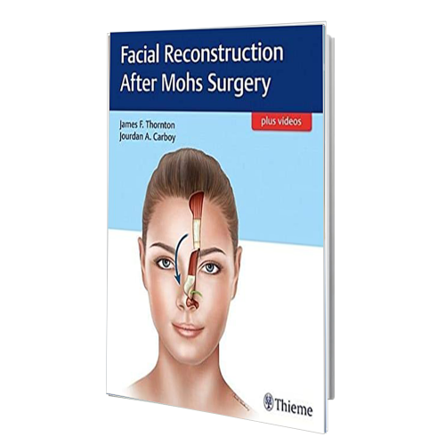 کتاب Facial Reconstruction After Mohs Surgery