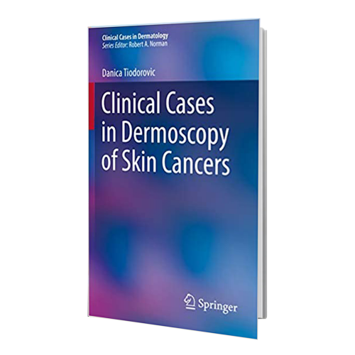 کتاب Clinical Cases in Dermoscopy of Skin Cancers