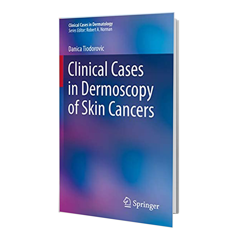 کتاب Clinical Cases in Dermoscopy of Skin Cancers