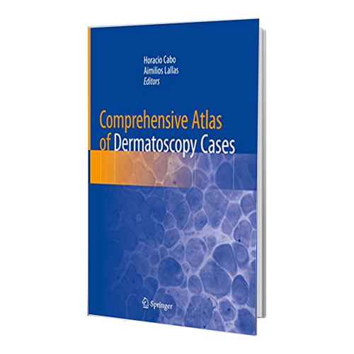 کتاب Comprehensive Atlas of Dermatoscopy Cases