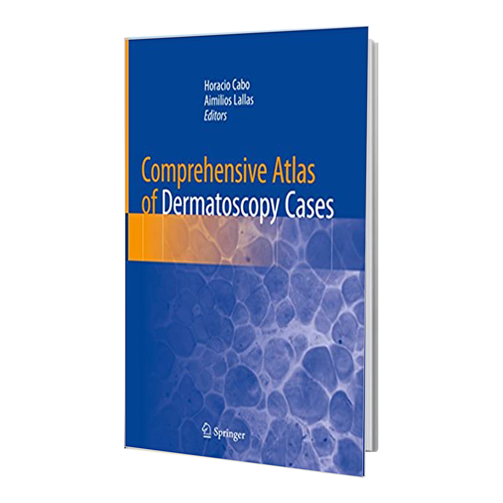 کتاب Comprehensive Atlas of Dermatoscopy Cases
