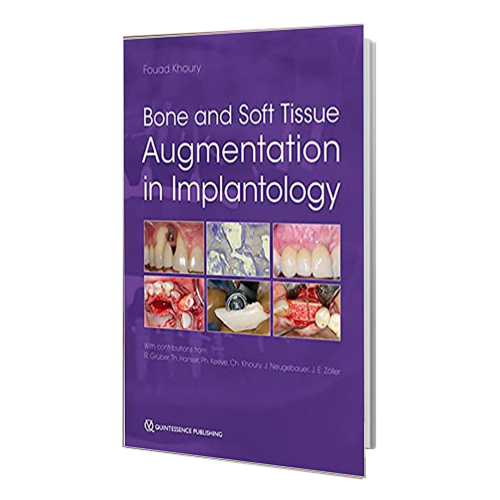 کتاب Bone and Soft Tissue Augmentation in Implantology