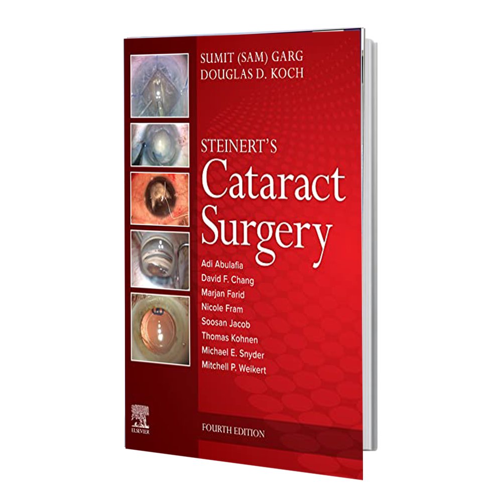 انتشارات رشد مثبت Cataract Surgery