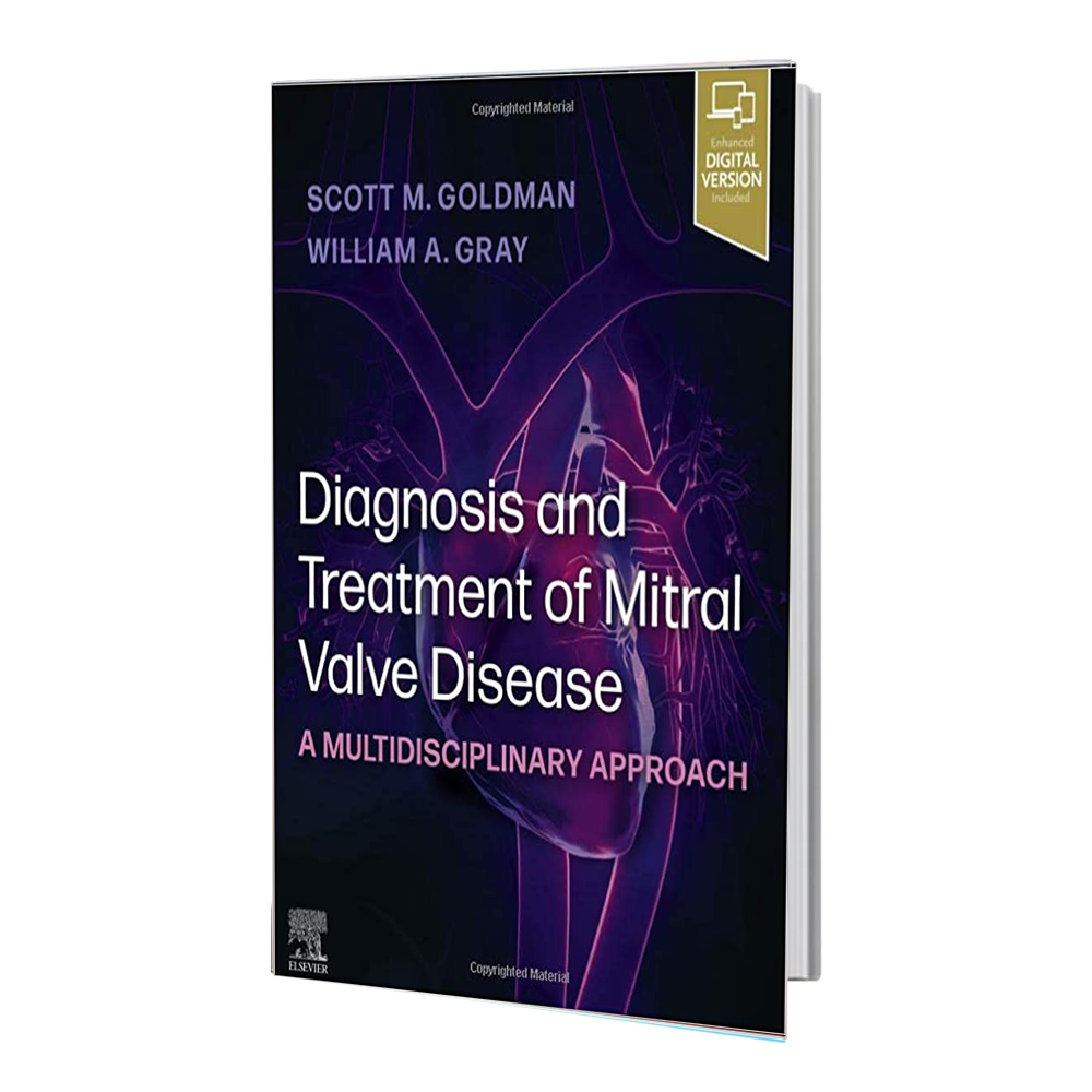 انتشارات رشد مثبت Diagnosis and Treatment of Mitral Valve Disease: A Multidisciplinary Approach